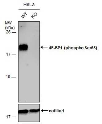 Western Blot: 4EBP1 [p Ser65] Antibody [NBP3-13171] - Wild-type (WT) and 4EBP1 (phospho Ser65) knockout (KO) HeLa cell extracts (30 ug) were separated by 15% SDS-PAGE, and the membrane was blotted with 4EBP1 (phospho Ser65) antibody (NBP3-13171) diluted at 1:500. The HRP-conjugated anti-rabbit IgG antibody (NBP2-19301) was used to detect the primary antibody, and the signal was developed with Trident ECL plus-Enhanced.